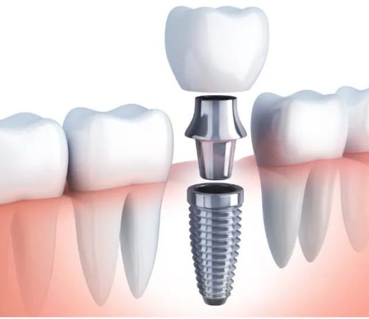 Oral Surgery: Advanced Procedures for Restoring Oral Health and Function